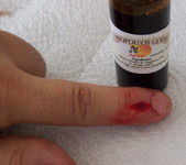 propoleo herida dedo